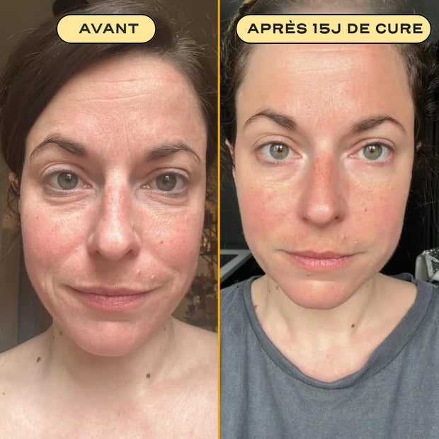COLLAGEN ESSENTIAL