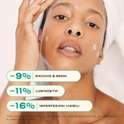 SOS Acne "Out"