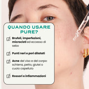 SOS Acne "In & Out"