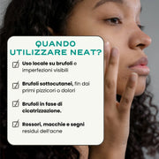 Duo SOS Acne "Out"