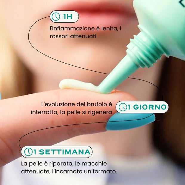 SOS Acne "In & Out"