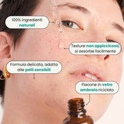 SOS Acne "In & Out"