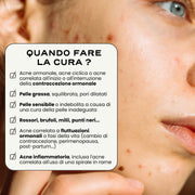 Trio SOS Acne "In & Out"